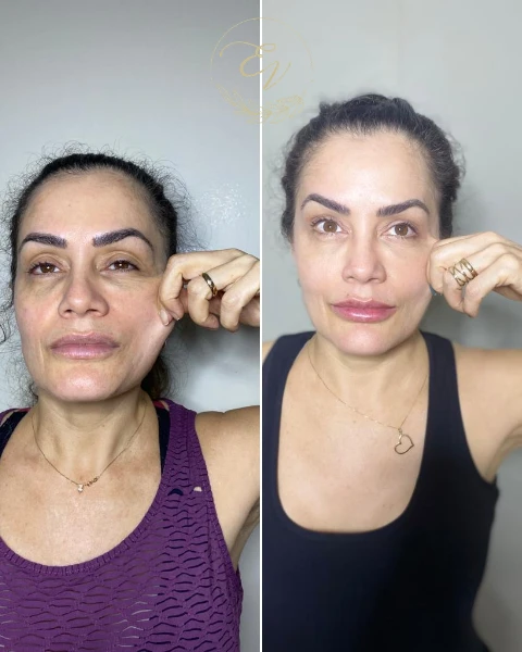 Resultado de paciente da Dra. Elaine Vasconcellos